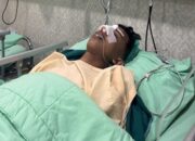 Siswa SMA Negeri 9 Pekanbaru Diduga Jadi Korban Pengeroyokan, Hidung Patah dan Mata Lebam